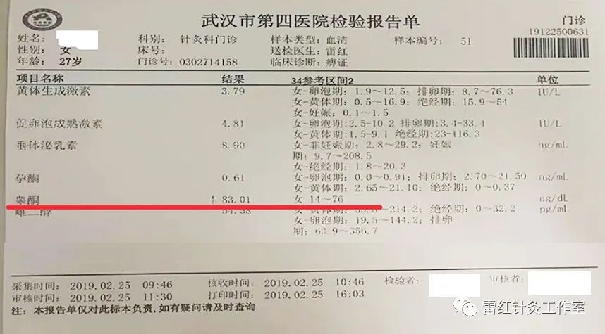 多囊卵巢综合征患者能自然怀孕吗？