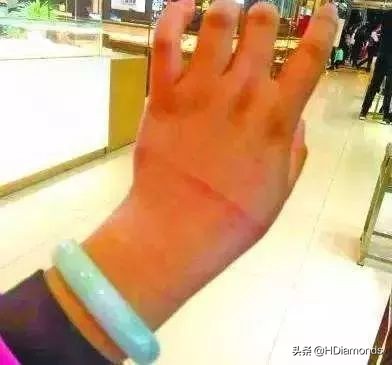 玉镯取不下来怎么办,玉镯卡在手上紧紧的怎么取出来