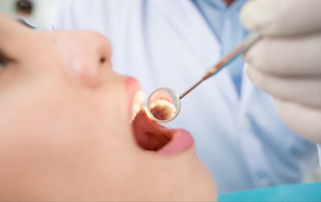 牙周病患者的个人护理,邯郸治疗牙周病