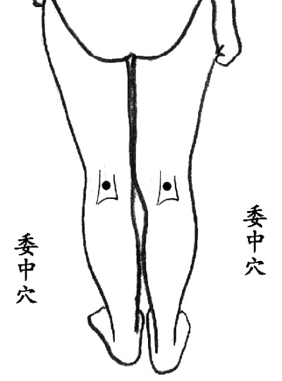 得了湿疹可以用红霉素软膏吗,脖子上的湿疹反复发作可以艾灸吗