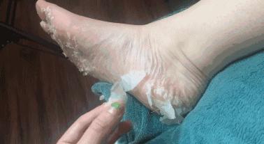 爽炸了!干丑裂的脚皮,一张完整撕掉,敢跟婴儿比姣嫩!