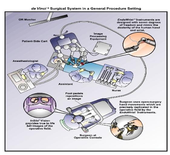 腹腔镜微创手术是做什么的,腹腔镜微创手术治疗啥的