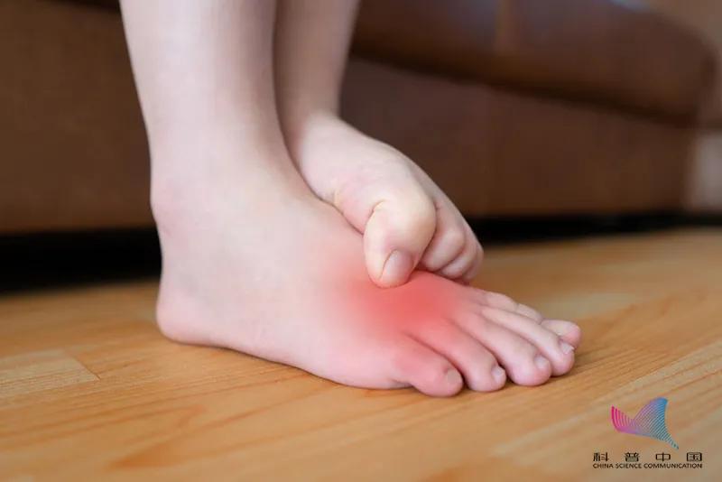 脚趾缝隙长鸡眼穿什么样的鞋合适,女人为什么喜欢穿尖头鞋