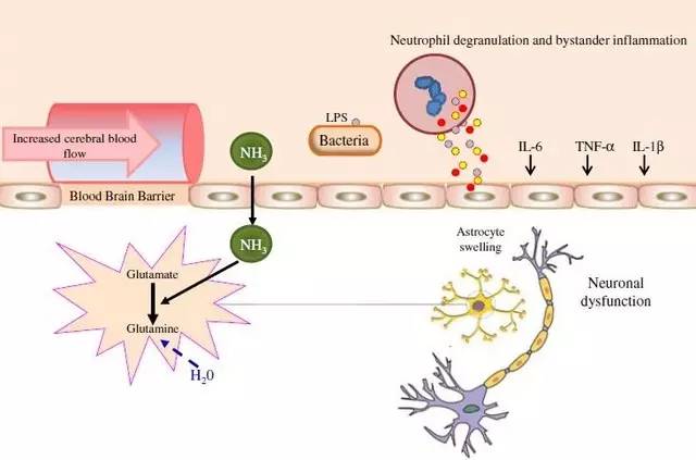 肝性脑病血氨降下来会升吗,肝性脑病怎样快速降血氨