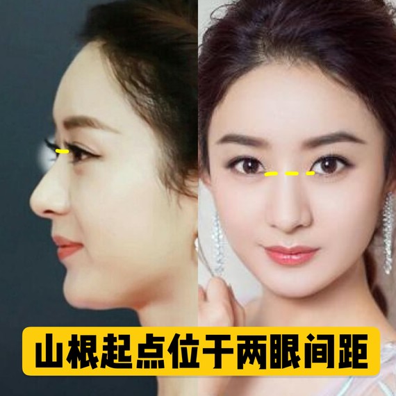 好看的鼻子类型驼峰鼻,好看的鼻型有哪几种