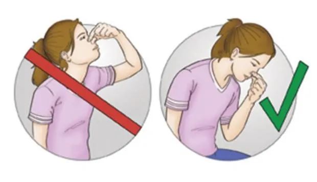 4岁男童鼻子渗血,五岁男童鼻流血不止抢救无效死亡