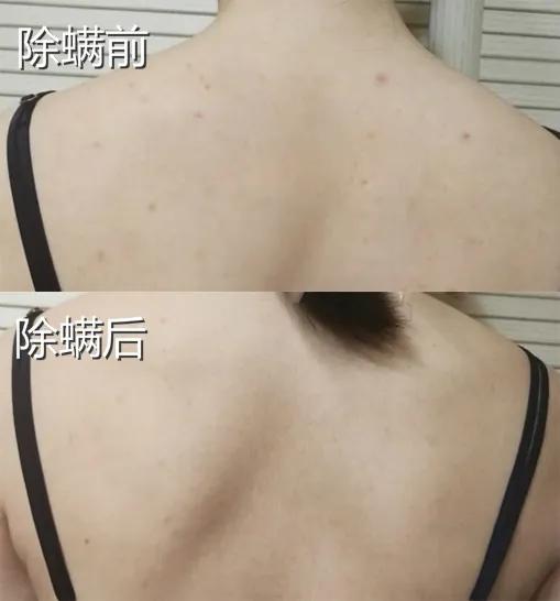 皮肤科医生都推荐的硫磺液体香皂，李佳琦5分钟卖了14406套