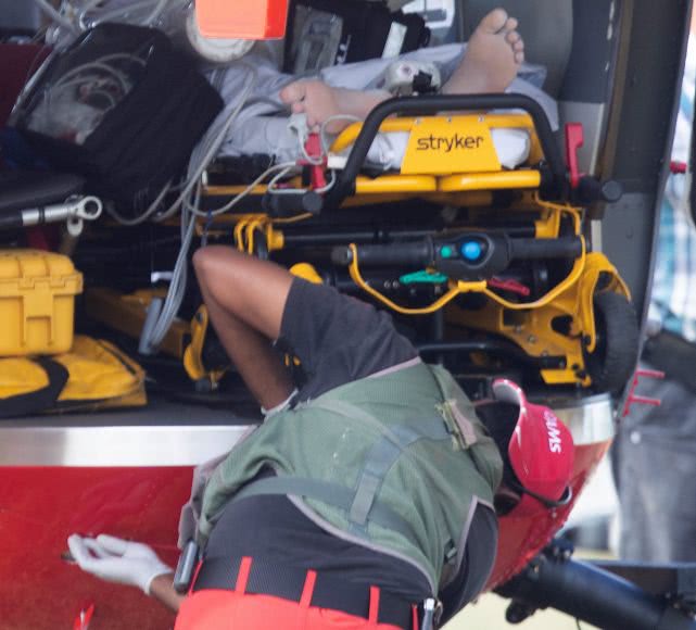 新西兰医疗免费治疗,新西兰烫伤药