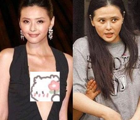 靠袒胸搏出位，3次吸毒被抓，如今患癌的她为保命切除5个器官