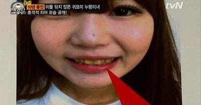 50岁种植牙,50岁了种植牙一颗多少钱