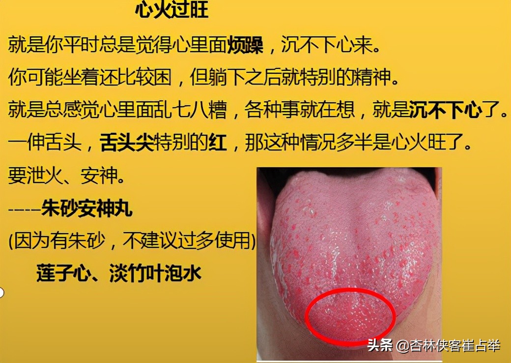 治疗失眠什么中成药效果好,治疗失眠中成药大总结