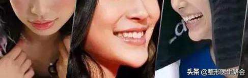 鐗欓娇澶栧嚫涓嬪反鍚庣缉鎬庝箞鐭,涓颁笅宸村彲浠ユ敼鍠勭墮榻垮悗缂╁悧