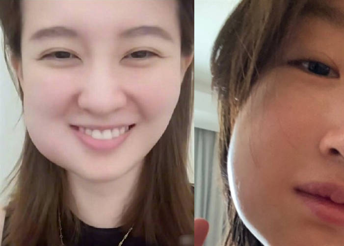 智齿拔牙后一般要痛多久,智齿拔牙不拔牙根会怎样