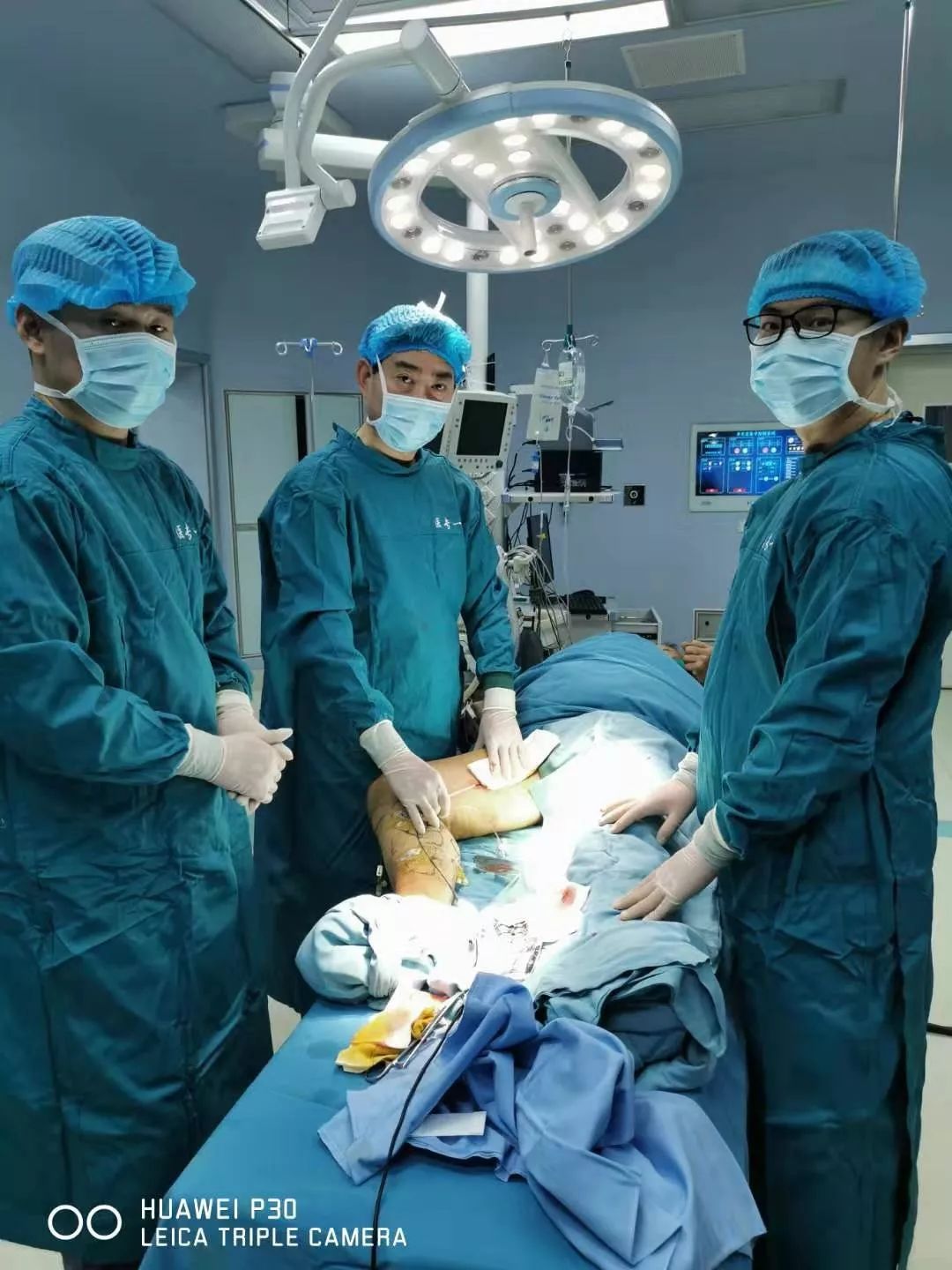 微创静脉曲张全国专家,治疗静脉曲张最新科技