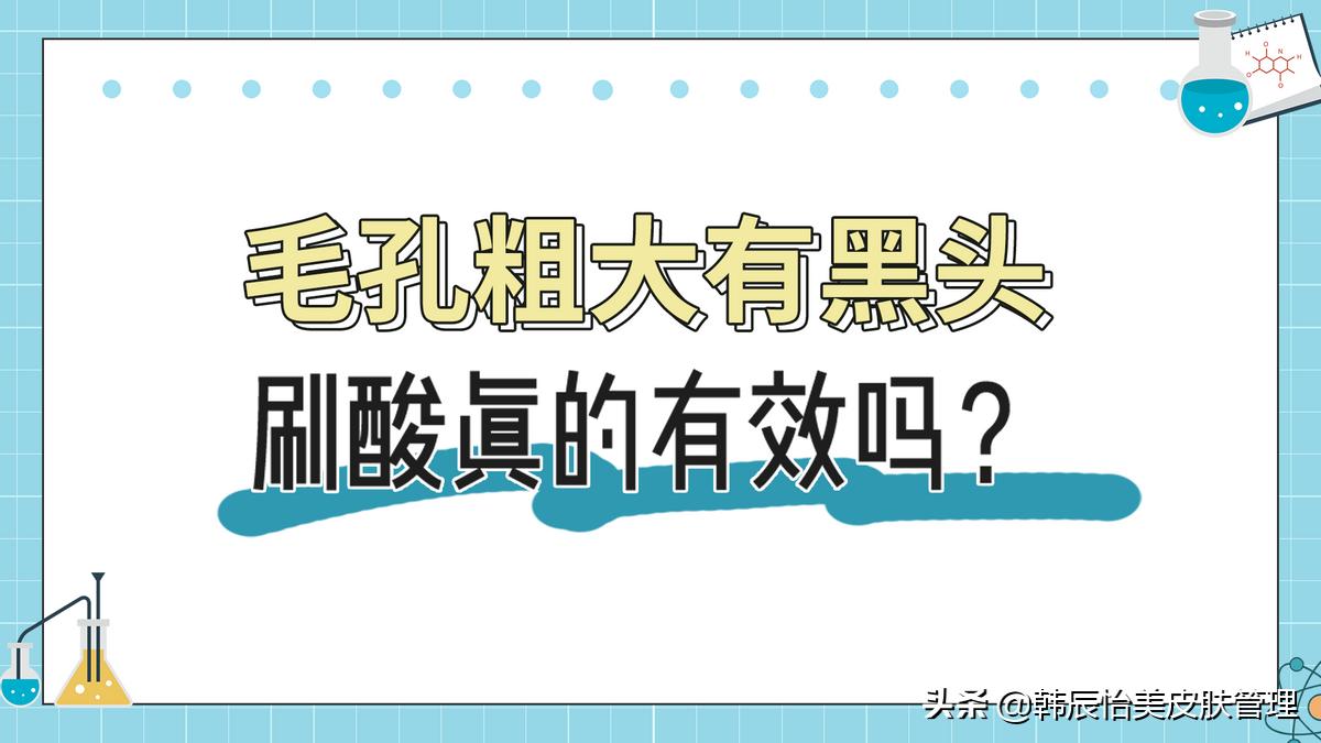 骆王宇毛孔粗大刷酸攻略,黑头闭口毛孔粗大敏感刷酸产品