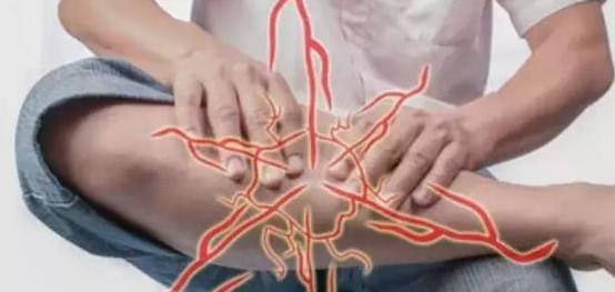 腘静脉血管闭塞腿脚晚上出汗好吗,血管狭窄引起腿脚阵疼吃什么蔬菜