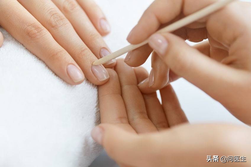 肝脏有问题手指甲有什么表现,手指甲条状不平整