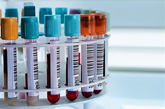 颅内海绵状血管瘤能治好吗,什么是颅内海绵状血管瘤