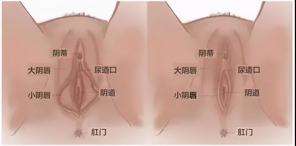 蝴蝶不对称？你会去做整形吗？