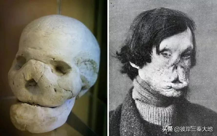 为中国“驱逐病魔”美国人马海德：娶了“延安第一美女”你知道吗