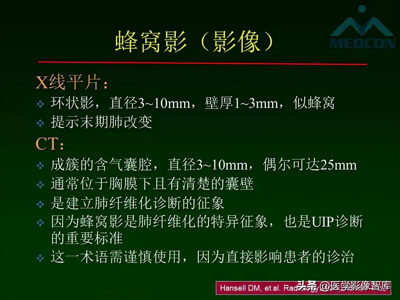 肺弥漫性网状影,两肺小叶间隔增厚可见网状模糊影