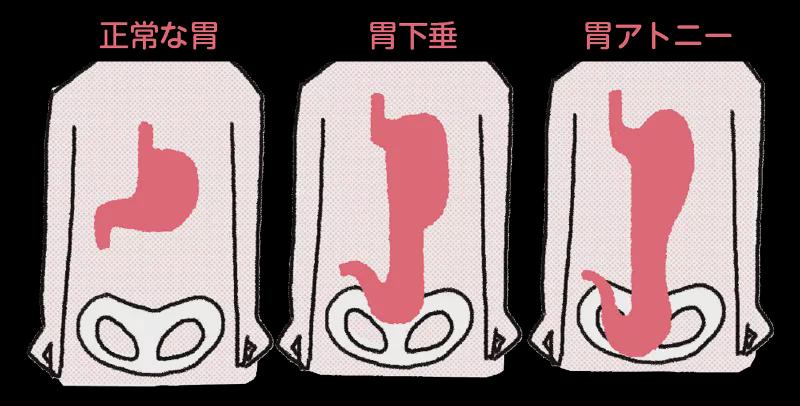 张钧甯素颜现身被*拍偷**！憔悴形象非常瘦，一双大长腿撑不满裤管