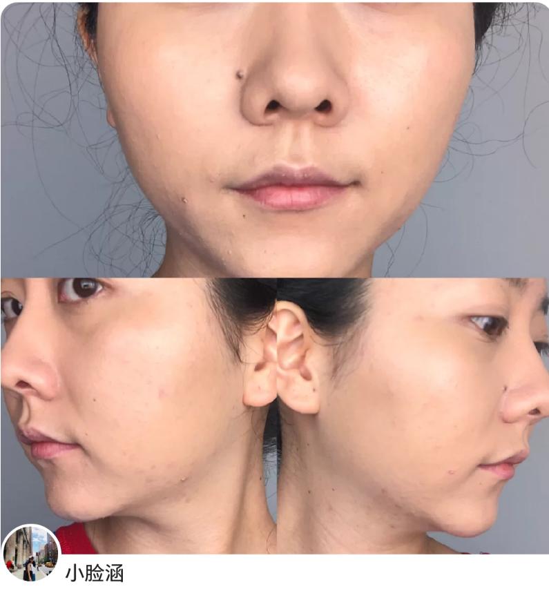 养肤型粉底液百元,适合干油皮的粉底液低价