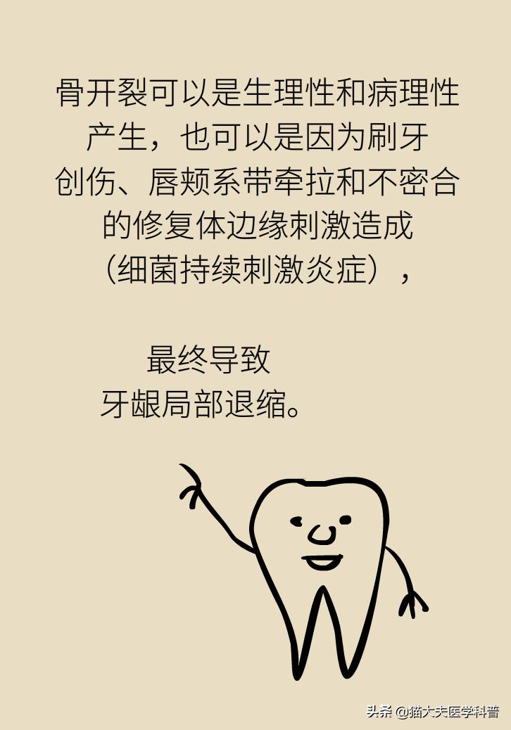 牙根露出来怎样修复不动刀,牙根暴露但没疼痛感怎么办