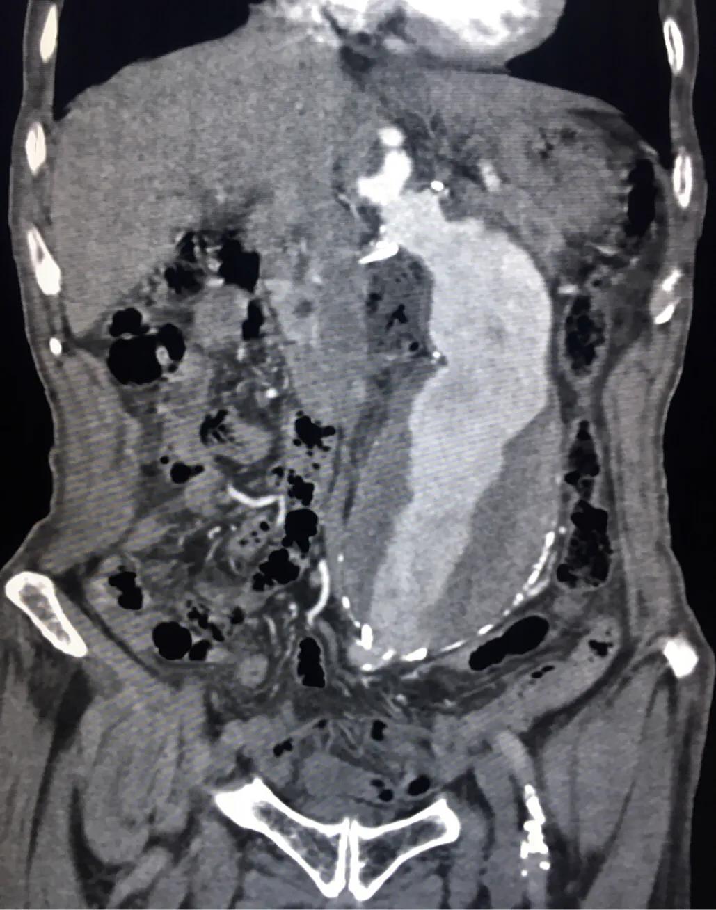 肚子疼要担心吗,肚子疼就是不来事儿