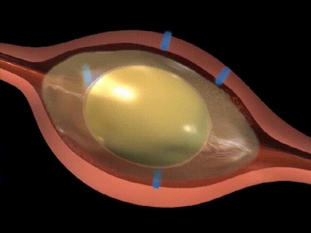 超生动|家禽生殖系统结构和禽蛋形成过程