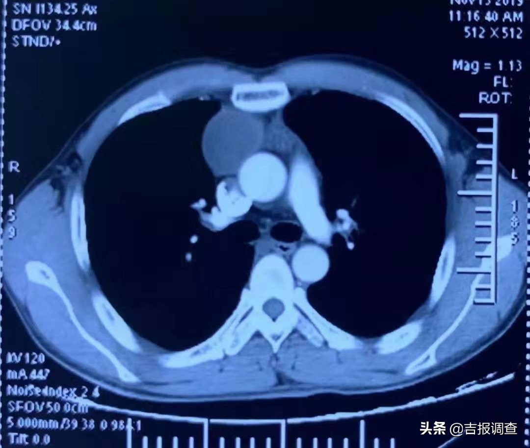 吉林国文医院介入科,吉林省国文医院
