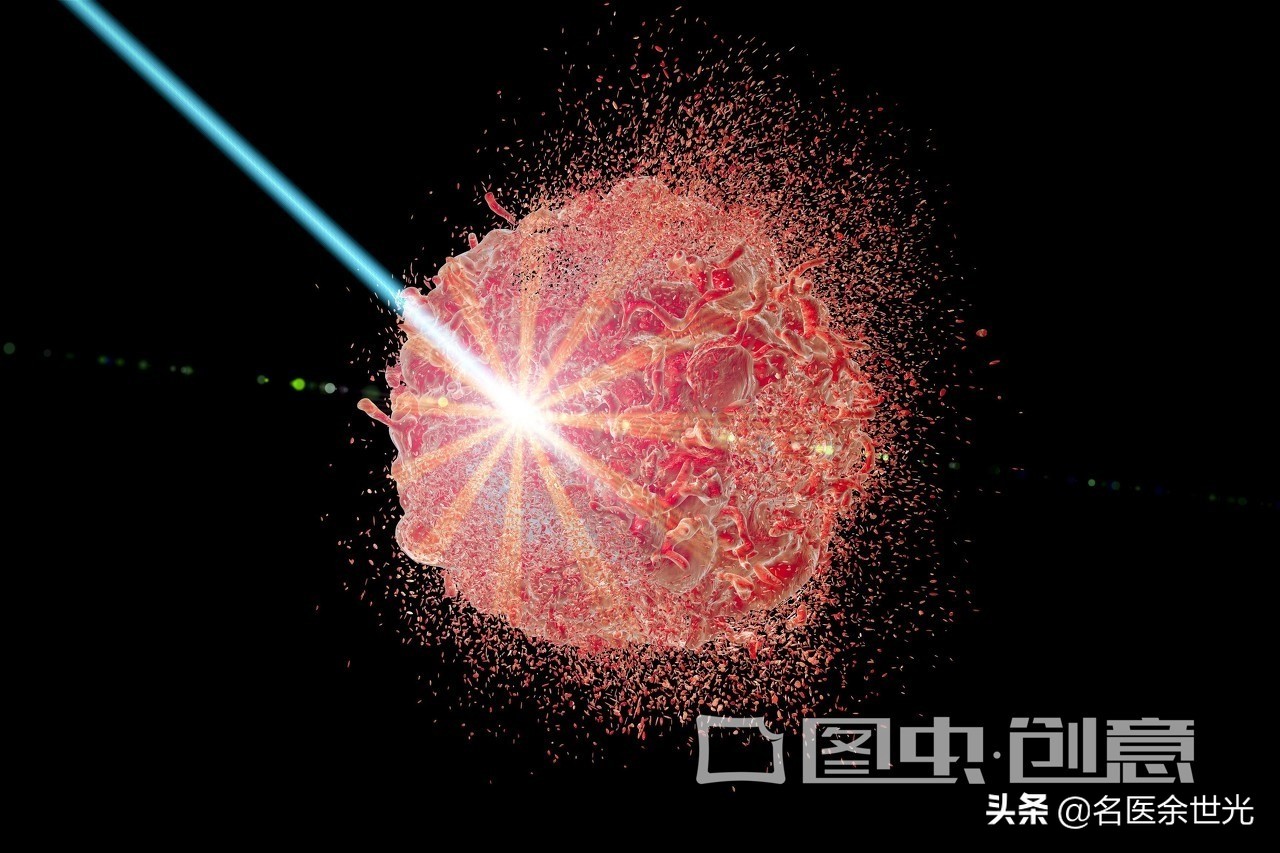 难言之隐如何解——尖锐湿疣