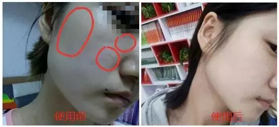 护肤太多的坏处有哪些呢,护肤越补越糟糕