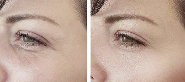 能放进包包的“美容院”,随时淡纹护眼,素颜美女少不了它