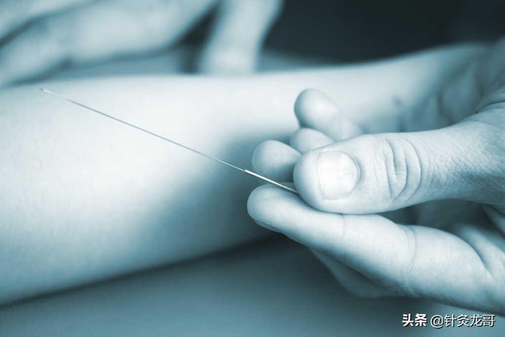初学者学习针灸，记住师父扎的每一个穴位，为什么还是没有疗效？