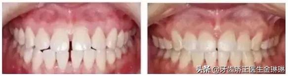 诺尔口腔牙齿矫正怎么样,淄博诺尔漫齿科种植牙价格