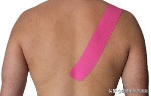 肩胛骨突出矫正的方法,体态矫正脊柱前凸