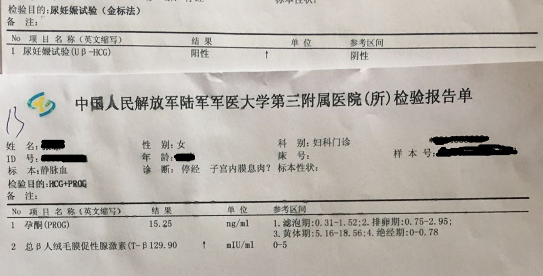 2次宫外孕的心酸,左右两侧都有过宫外孕的经历