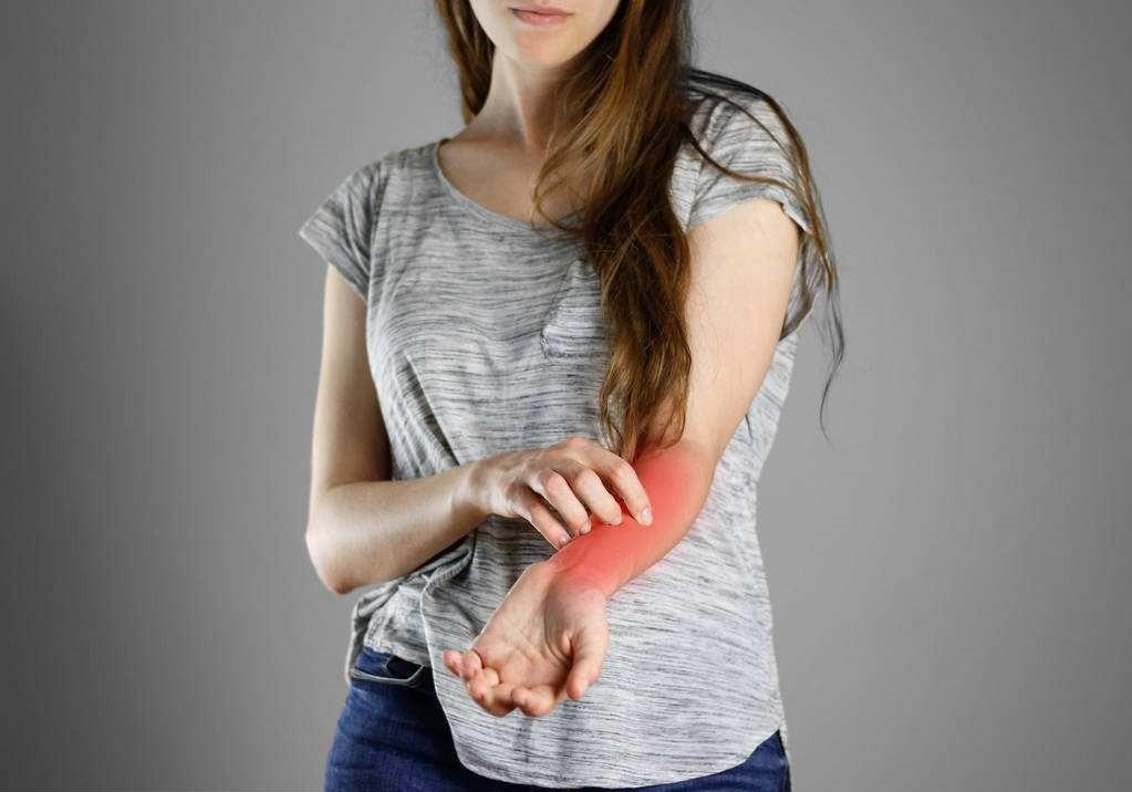 10个月白色糠疹的症状和治疗,圈状糠疹