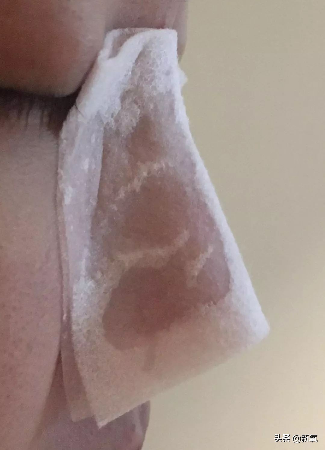 目前有真正去黑头的方法,最近超火的去黑头