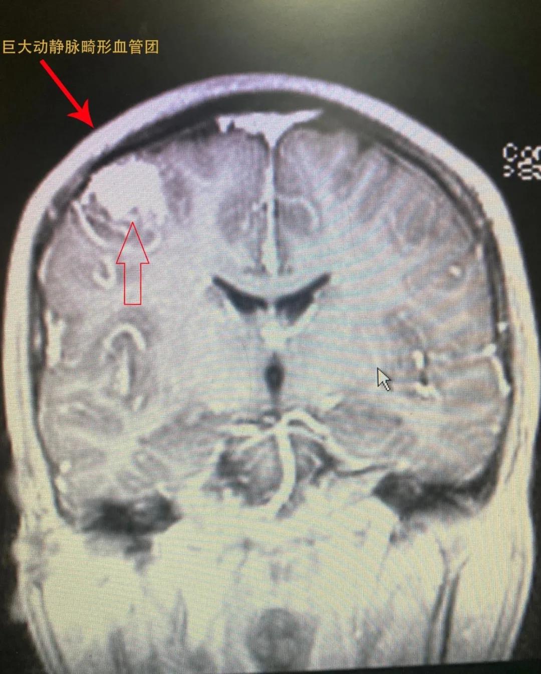 普洱市人民医院神经内科,思茅区人民医院神经外科