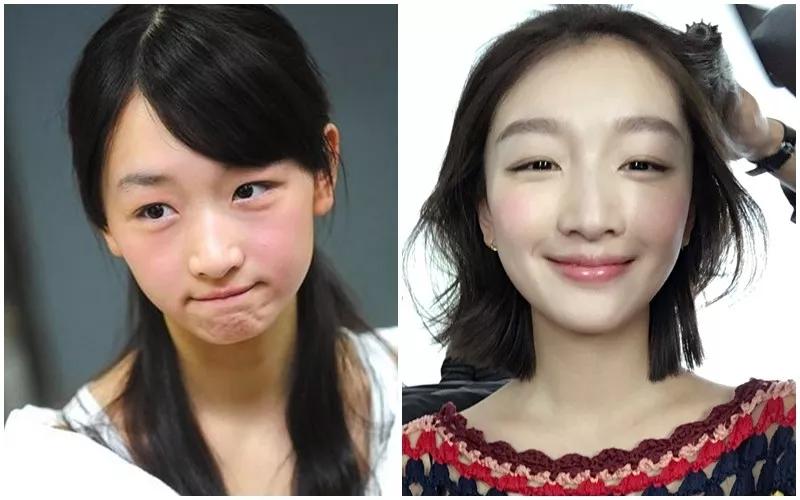 周冬雨过去的小粗腿,小粗腿逆袭