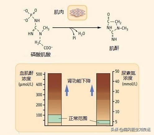 痛风引起的肌酐高怎么治疗,痛风肌酐高需要看肾内科吗