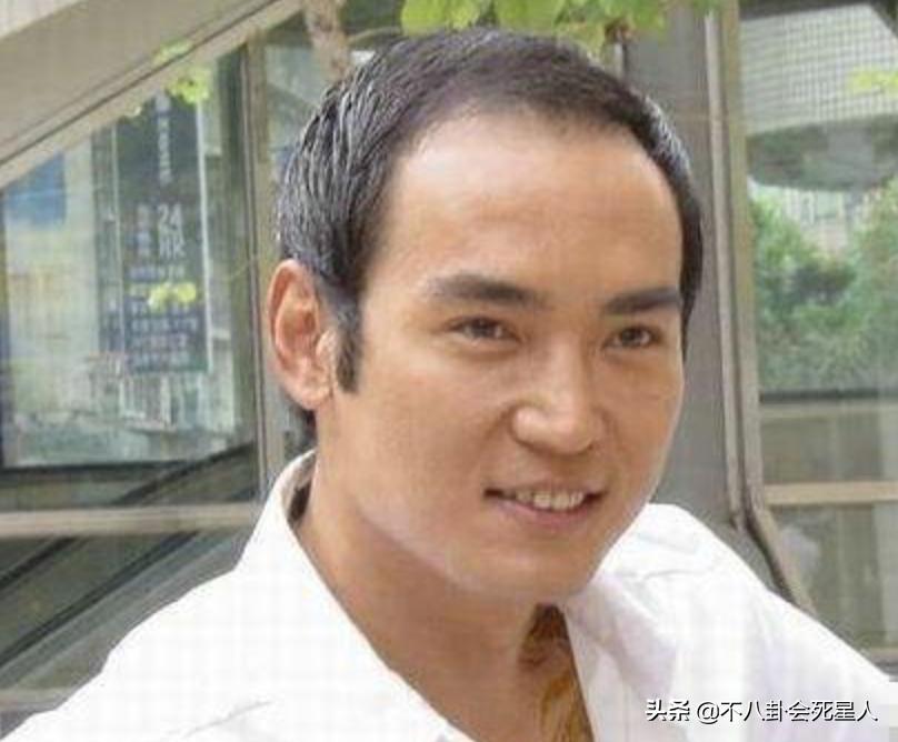 沙溢黄晓明脱发指数,沙溢秃顶头发稀疏