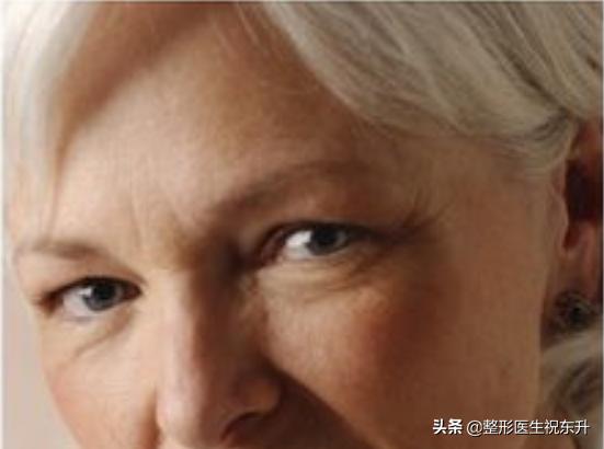 下眼皮松弛没有眼袋能外切吗,眼睛痒干能不能做切眼袋手术