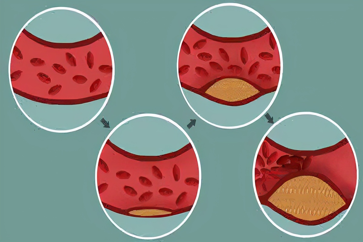 早上醒来后双手发胀五指握不紧,早晨起床感觉双手发胀是怎么回事