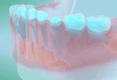 如何预防宝宝的双排牙,换牙出现双排牙不齐怎么办