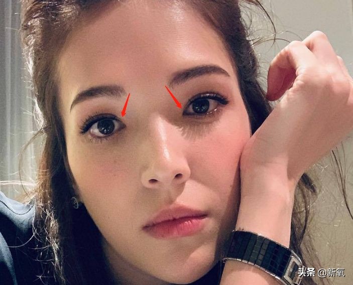 盘点整容后不敢认的女星颜值巅峰,知名女网红被扒整容