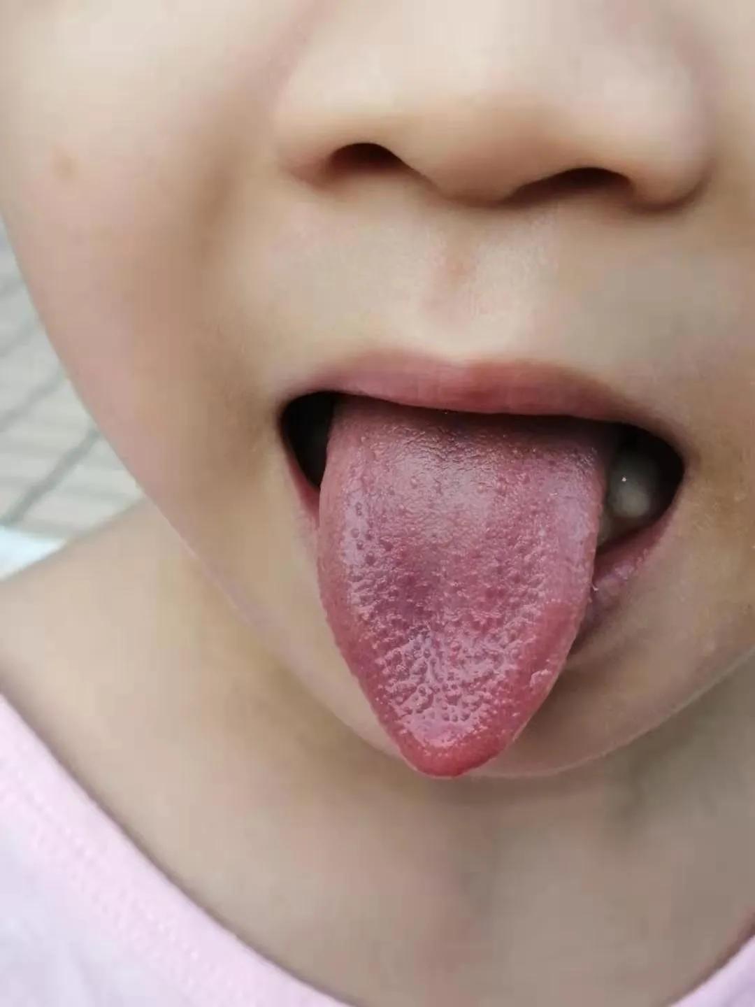 便秘拉羊屎食疗有哪些,孩子总是拉羊屎蛋排便困难怎么办