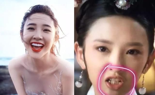 明星牙齿矫正过的图片对比,明星的牙齿怎么都是全部整的吗